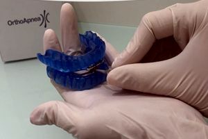El dispositivo de avance mandibular Orthoapnea